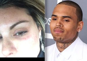 Kdysi zbil Rihannu, teď je Chris Brown obviněn z dalšího napadení