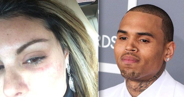 Kdysi zbil Rihannu, nyní je Chris Brown vyšetřován kvůli dalšímu napadení