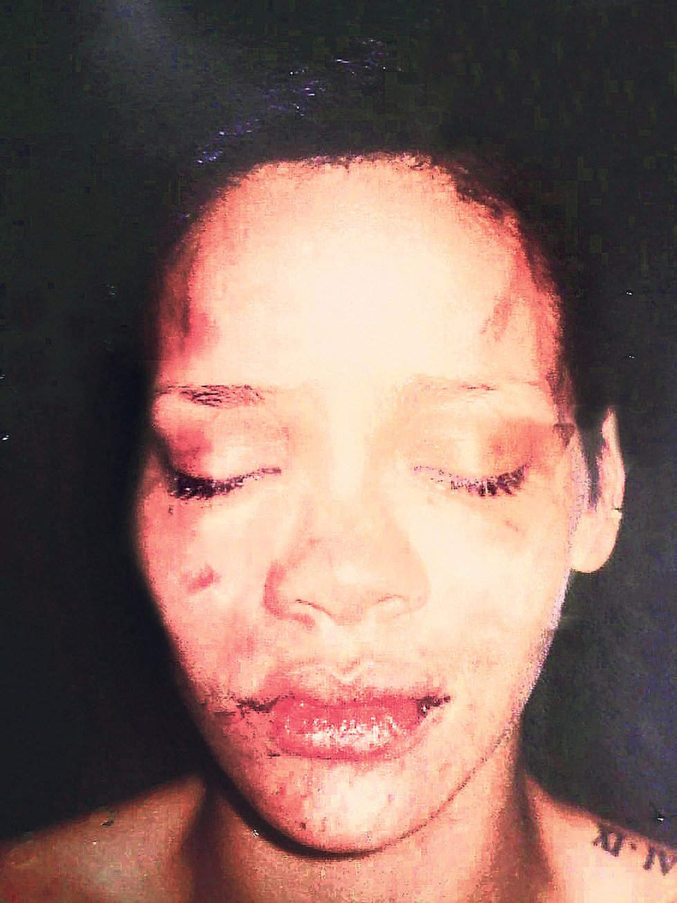 Takhle vypadala Rihanna poté, co ji Brown zmlátil.