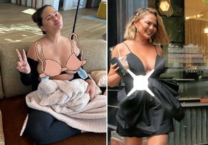 Chrissy Teigen