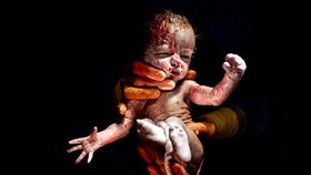 Fotograf zaznamenává první okamžiky života dětí narozených císařským řezem.