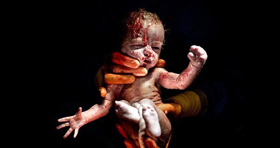 Fotograf zaznamenává první okamžiky života dětí narozených císařským řezem..