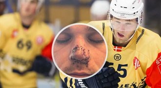 Hrůza dánského hokejisty Wejseho: Usekl si nos
