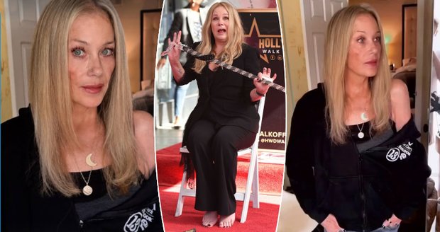Christina Applegate výrazně zhubla... a ukázala flek na obličeji
