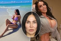 Dvojnice Kim Kardashianové zemřela po injekci: Úprava zadku ji stála život