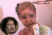 Zjizvená a popálená: Tak dopadla chůva Kaddáfího vnuků