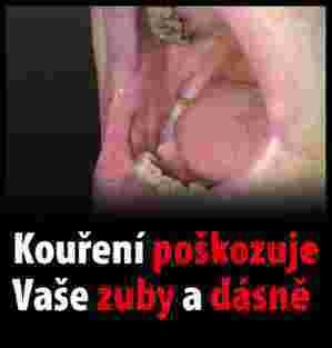 Děsivé obrázky mají na krabičkách i cigarety v Česku.