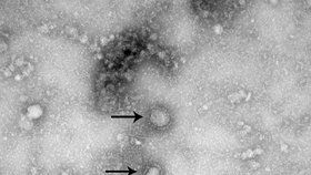 Takhle vypadá koronavirus pod mikroskopem.