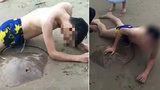 Šplouchačka v moři skončila tragicky: Rejnok muži propíchl penis!