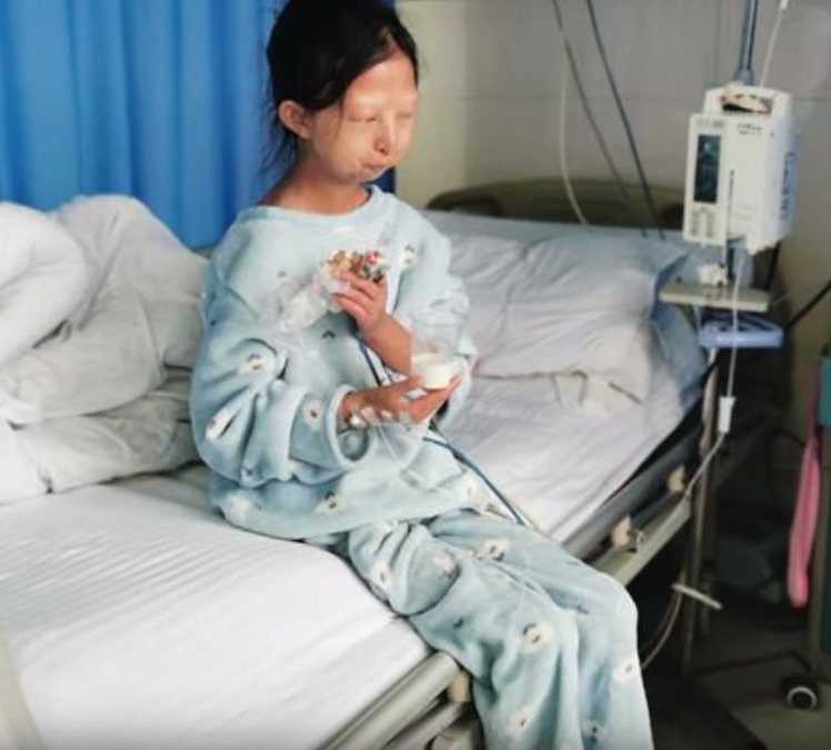 V Číně zemřela silně podvyživená studentka, která kvůli bratrovi žila jen ze dvou juanů (6,50 korun) denně.