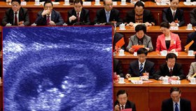 Děsivá čínská politika jednoho dítěte: Za 40 let provedli lékaři 330 milionů potratů