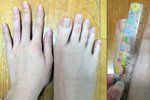 Číňanka se pyšní bizarní anomálií! Prsty na nohou má dlouhé 5 centimetrů!
