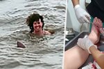Na Claire (28) během koupání zaútočil delfín.