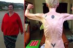 Claire Huxtable (44) jde z extrému do extrému. Z původních téměř 160 kilogramů teď váží pouhých 32 kilo. A bojuje o život.