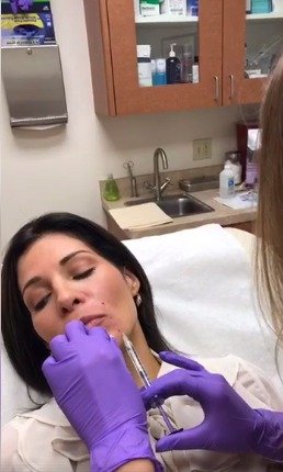 Claudia Sierra si nechala do obličeje píchnout injekce botoxu.