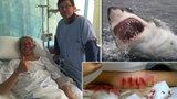 Surfaře pokousal 3,5metrový žralok, na noze mu vykousl kusy masa