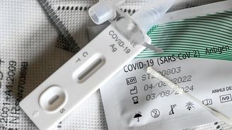 Covid-19 v roce 2024: Příznaky, test, očkování, postup při nákaze