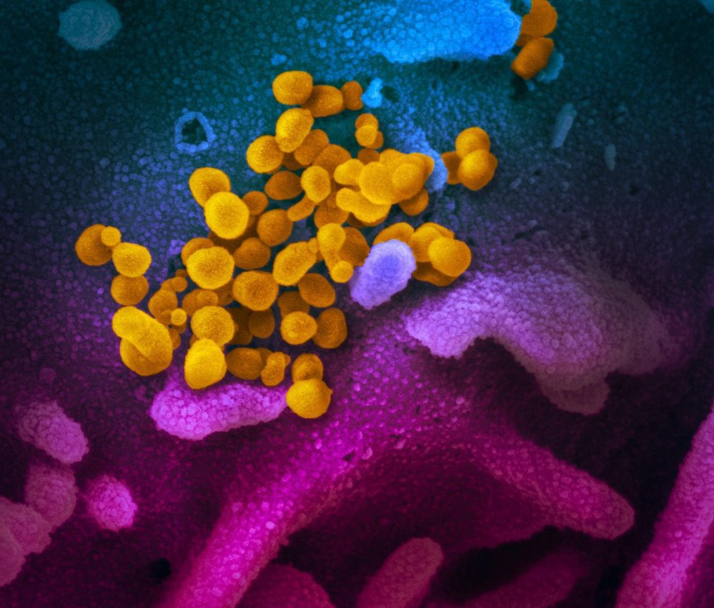 Obarvená fotografie nového koronaviru (žlutě) z elektronového mikroskopu