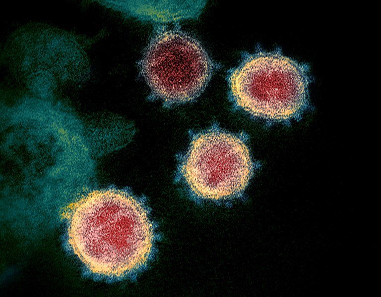 Původce pandemie onemocnění COVID-19, virus SARS-CoV-2 na snímku z elektronového mikroskopu