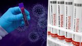 Vzestup chřipky i covidu-19: Na vině je počasí, slabší imunita a ztráta ostražitosti, tvrdí praktici