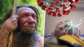 Pravděpodobnost těžkého covidu zhoršuje neandertálský gen. Má ho každý sedmý Evropan