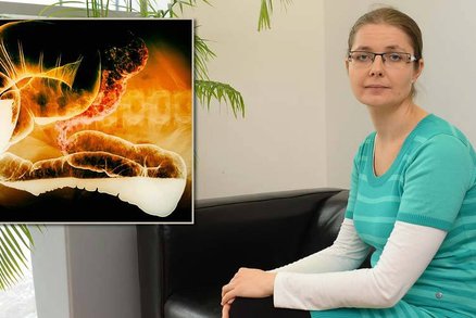 Veronika (33) trpí nemocí střev: Vše se zhoršilo, když mi tragicky zemřel přítel