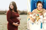 Žena s cukrovkou porodila čtyřčata. Jedno děťátko má trvalé následky