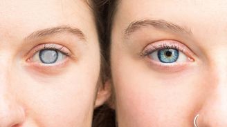 Vidíte hůř než dřív? Bacha, může jít o tuto nemoc! Vidíte hůř než dřív? Bacha, může jít o tuto nemoc!