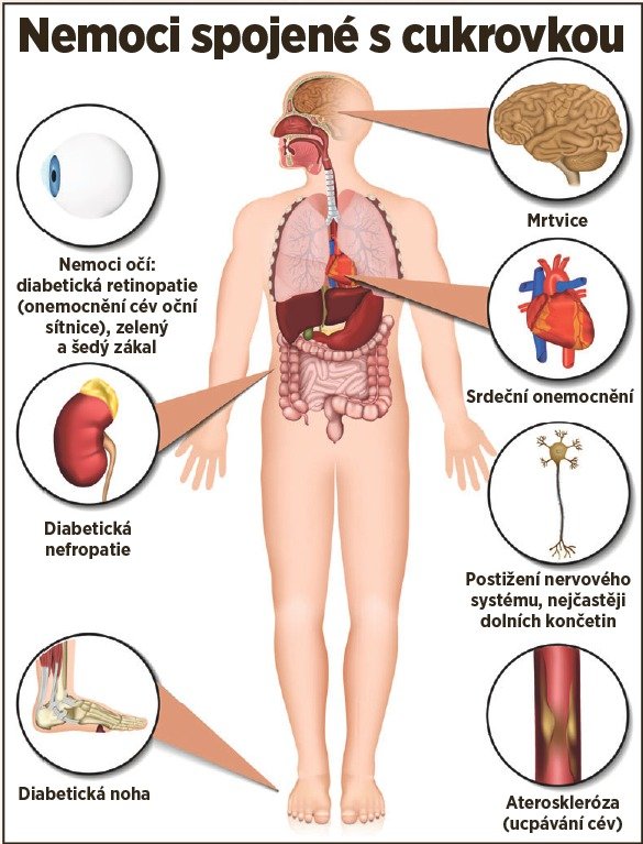 Nemoci spojené s cukrovkou