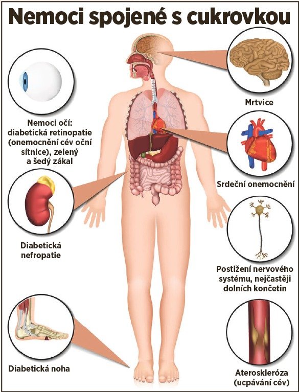 Lékař Marek se zaobíral průkopnickými možnostmi léčby cukrovky. (ilustrační foto)