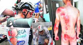 Němec Tony Martin jede Tour de France s bolavým zraněním: Krvavá záda!