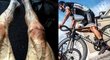 Polský cyklista Pawel Poljanski a jeho zničené nohy po jedné z etap Tour vyvolaly pozornost
