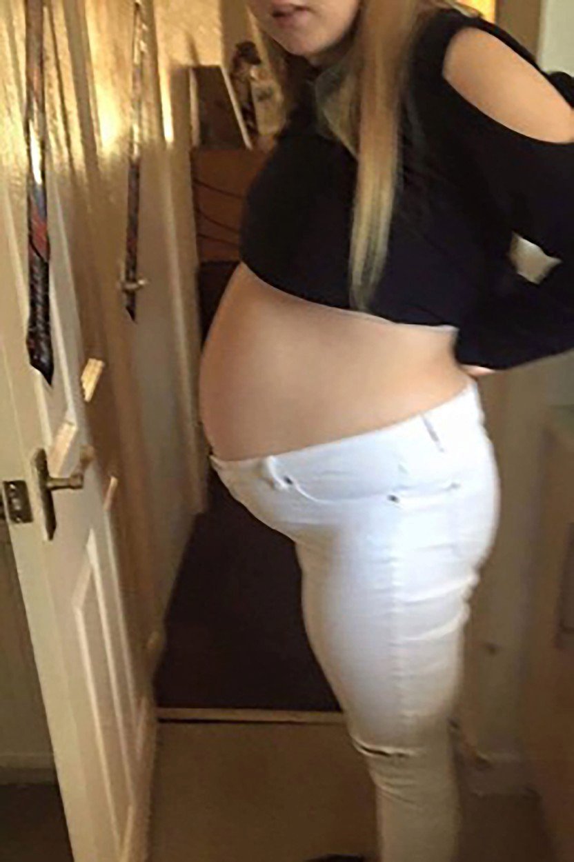 Takhle vypadalo její břicho s cystou, která jí tlačila na dělohu.