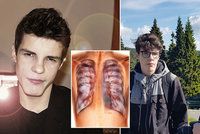 Jaroslav (19) trpí nevyléčitelnou nemocí, která ničí plíce: Zkoušej, dokud dýcháš, vzkazuje!