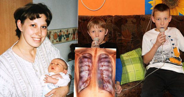 Alena má „slané děti“. Zákeřnou chorobu dýchacích cest trpí oba její synové