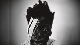 Porota tři dny probírala více než 4 tisíce fotek, aby se nakonec rozhodla pro tuto. Jde o dívku ošetřenou v nemocnici v Port-au-Prince na Haiti. „Obraz je ohromující a silně působivý,“ shodla se porota.