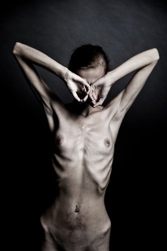 PORTRÉT 2012 (2. cena) - Anorexie, září 2012