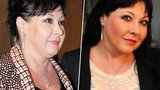 Patrasová: Nechala si odstranit nechutnou jizvu!