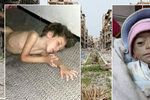 Kvůli hladu v Sýrii umírají malé děti.