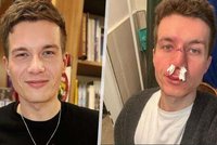 Herec Daniel Krejčík (31): Krvavý úraz na ledu!