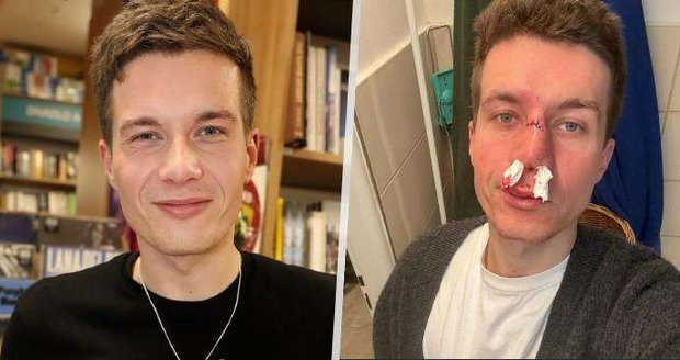 Daniel Krejčík po ošklivém pádu