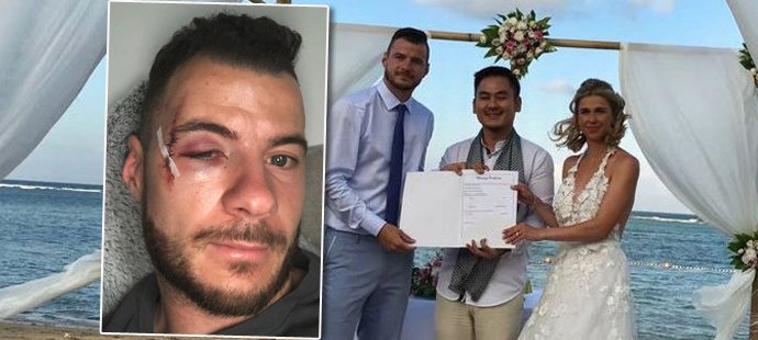 Daniel Pudil, který nedávno utrpěl ošklivé zranění, měl neoficiální svatbu na Bali, jeho Veronika už ale randí s pilotem...