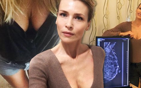 Daniela Peštová udělala online přenos ze svého mamografického vyšetření