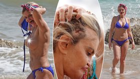 Drogami zničená celebrita se vyprsila na pláži:  Ukázala silikony i jizvy po plastice