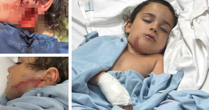 Dante Skordas (6) utrpěl vážná poranění na obličeji poté, co ho napadl pitbul.