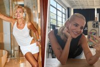 Dara Rolins ukázala výsledek dva roky po plastice a fanouškům vytřela zrak