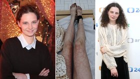 Hvězda StarDance Pavlovičová (21) po návštěvě sauny: Nohy zalité krví!