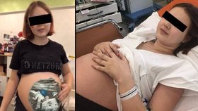 Dětská maminka Dáša (15) šokuje: Musím na potrat!
