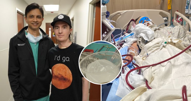 Američanovi vapování zničilo plíce: Život mu zachránily prsní implantáty!