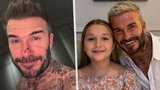 David Beckham ukázal krvavé zranění: Dcera (10) mě pokousala!